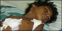 Wounded girl