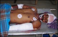 DPU Claymore attack