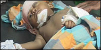 A child seriously injured in SLA artillery shelling